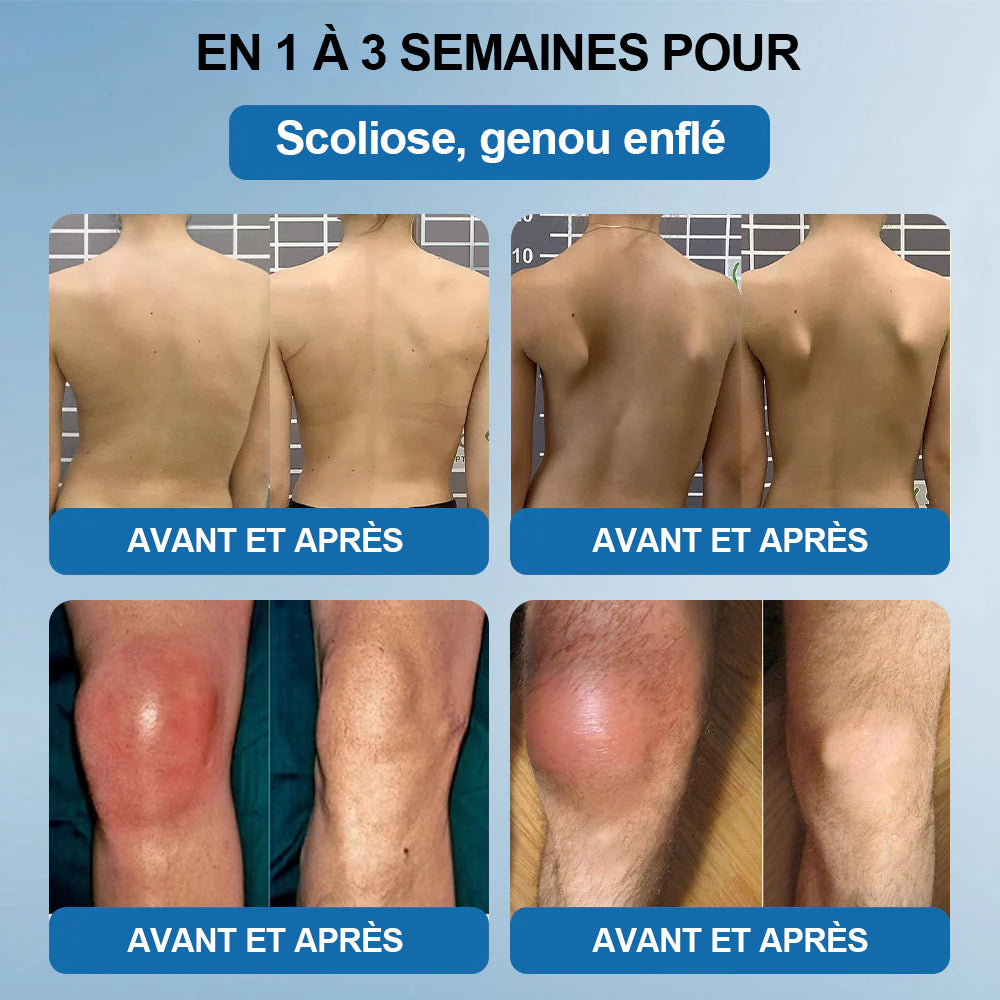 𝖯𝗂𝖼𝗱𝗼® BPC-157 Crème de Réparation des Articulations 🦴 Traite l'arthrite, la neuropathie, le rhumatisme, les blessures sportives et bien plus 🦿🦿🦿