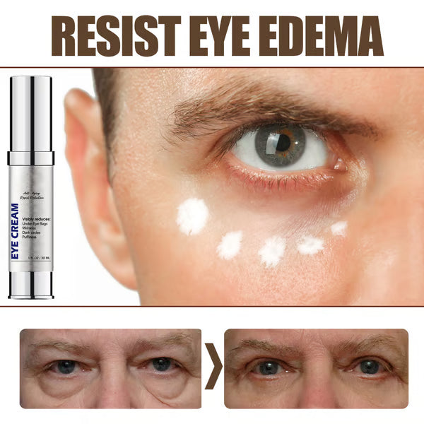 Anti-wrinkle Magic Eye Creamš„BUY 2 GET 1 FREEš„