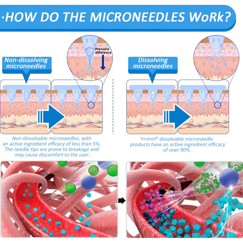 Yestree®👨⚕️ Nano Microneedle Patch with SMGT-GLP-1 & Matrixyl 3000 – Slimming, Skin Tightening, Blood Sugar Support, No Injection, 7-Day Result