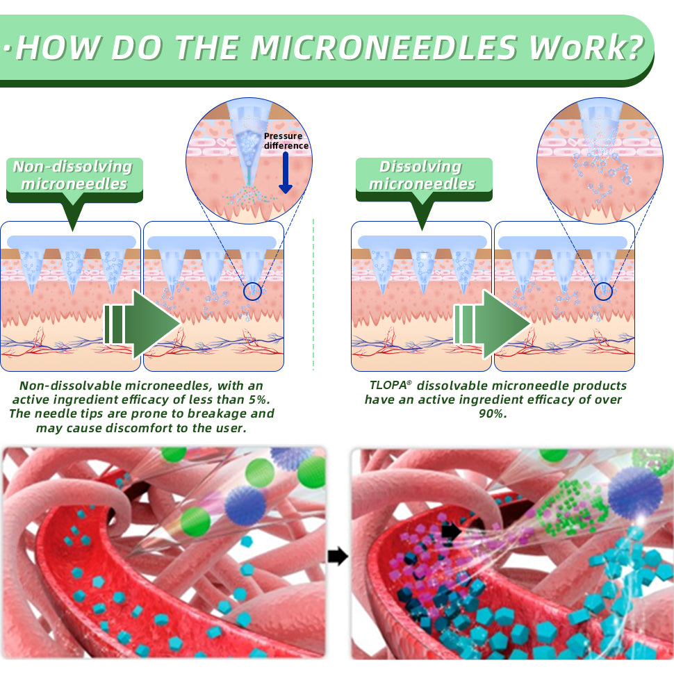 [See results in 7 days]🇬🇧 TLOPA® GLP-1 Nano Microneedle Patch👍(Painless, long-lasting, addressing diabetes, obesity, and cardiovascular diseases)🍃