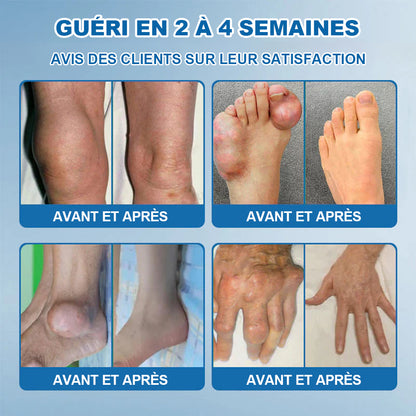 💖🦿🦿𝖯𝗂𝖼𝗱𝗼® BPC-157 Crème de Réparation des Articulations 🦴 Traite l'arthrite, la neuropathie, le rhumatisme, les blessures sportives et bien plus