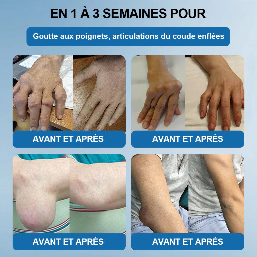 💖🦿🦿𝖯𝗂𝖼𝗱𝗼® BPC-157 Crème de Réparation des Articulations 🦴 Traite l'arthrite, la neuropathie, le rhumatisme, les blessures sportives et bien plus