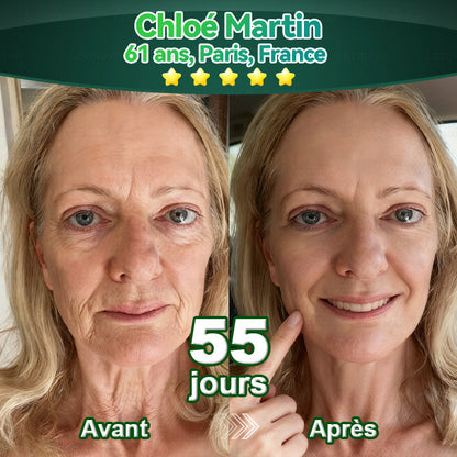 【Édition Exclusive Officiellement Autorisée】Lotmay® Sérum Oral de Cellules Souches et Peptides de Collagène 🛒(Raffermit et Tonifie la Peau Relâchée & Réduit la Formation de Rides）🌸