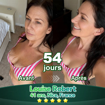 【Édition Exclusive Officiellement Autorisée】Lotmay® Sérum Oral de Cellules Souches et Peptides de Collagène 🛒(Raffermit et Tonifie la Peau Relâchée & Réduit la Formation de Rides）🌸