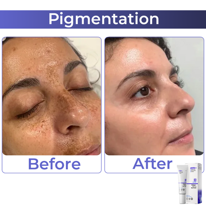 🧡 flysmus™ Collagen+ Wake Up Eye Cream 🇺🇸 Dermatologist Recommended