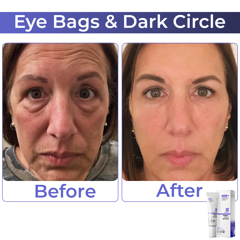 🧡 flysmus™ Collagen+ Wake Up Eye Cream 🇺🇸 Dermatologist Recommended