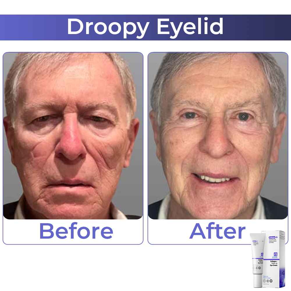 🧡 flysmus™ Collagen+ Wake Up Eye Cream 🇺🇸 Dermatologist Recommended